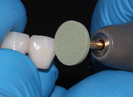 SHOFU Dental Corporation ZiLMaster