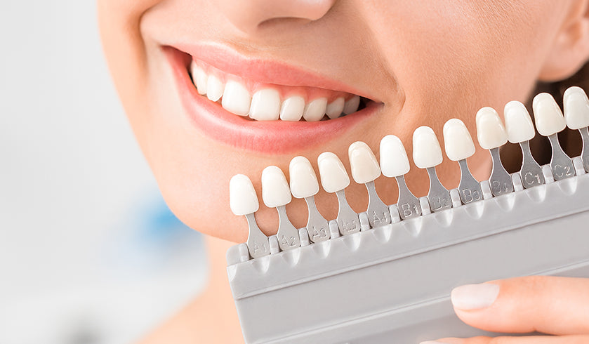 Tooth Whitening