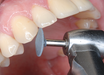 SHOFU Dental Corporation CeraMaster Coarse and CeraMaster