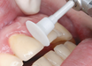 SHOFU Dental Corporation OneGloss PS