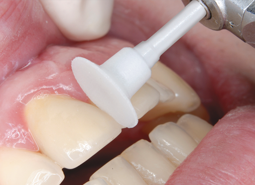 SHOFU Dental Corporation OneGloss PS