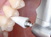 SHOFU Dental Corporation OneGloss