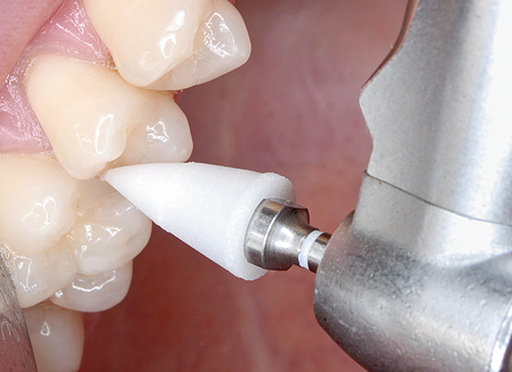 SHOFU Dental Corporation OneGloss