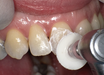 SHOFU Dental Corporation Super-Snap SuperBuff Disk
